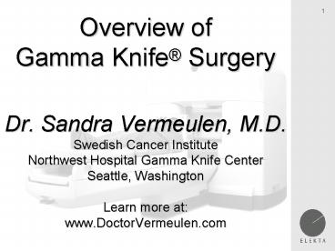 Overview of Gamma Knife