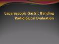 Laparoscopic Gastric Banding Radiological Evaluation PowerPoint PPT Presentation