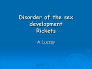 Disorder of the sex development Rickets