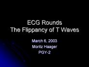 ECG Rounds The Flippancy of T Waves