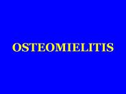 OSTEOMIELITIS
