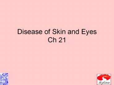 Disease of Skin and Eyes Ch 21
