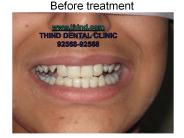 Ortho TREATMENT