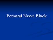 Femoral Nerve Block