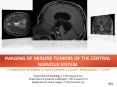 IMAGING OF MIDLINE TUMORS OF THE CENTRAL NERVOUS SYSTEM PowerPoint PPT Presentation