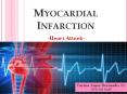 Myocardial Infarction PowerPoint PPT Presentation
