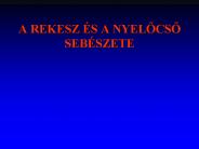 A REKESZ 