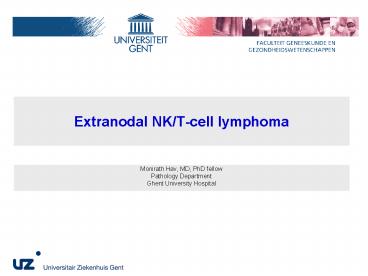 Extranodal NK/T-cell lymphoma