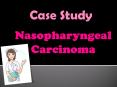 Nasopharyngeal Carcinoma PowerPoint PPT Presentation