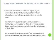 Home Remedies For Acne (Pimple)