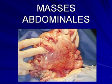 MASSES ABDOMINALES