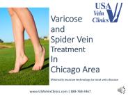 Hair Restoration Treatment In Chicago