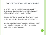 Natural Cure For Acne Scar