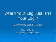 When Your Leg Just Isn