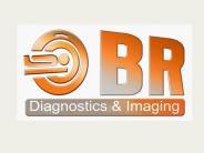 What Is CT Angiography?