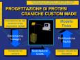 PROGETTAZIONE DI PROTESI CRANICHE CUSTOM MADE PowerPoint PPT Presentation