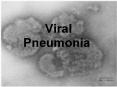Viral Pneumonia PowerPoint PPT Presentation