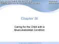 Caring for the Child with a Musculoskeletal Condition PowerPoint PPT Presentation