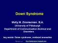 Down Syndrome PowerPoint PPT Presentation