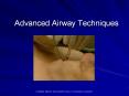 Advanced Airway Techniques PowerPoint PPT Presentation