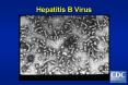 Epidemiology and Prevention of Viral Hepatitis A to E: PowerPoint PPT Presentation