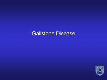 Gallstone Disease