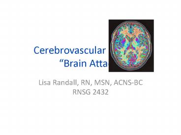 Cerebrovascular Accident 