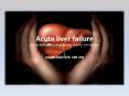Acute liver failure William Bernal, Georg Auzinger, Anil Dhawan, Julia Wendon PowerPoint PPT Presentation
