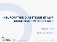 NEUROPATHIE DIAB