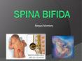 Spina Bifida PowerPoint PPT Presentation