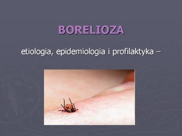 BORELIOZA