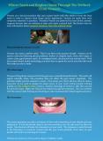 Whiter Tooth and Brighter Smile Through The Welbeck Clinic Veneers PowerPoint PPT Presentation