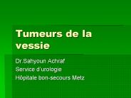 Tumeurs de la vessie