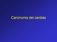 Carcinoma del cardias