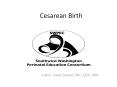 Cesarean Birth PowerPoint PPT Presentation