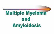Multiple myeloma - definition