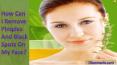 How Can I Remove Pimples And Black Spots On My Face PowerPoint PPT Presentation
