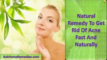 Natural Remedy To Get Rid Of Acne Fast And Naturally