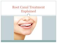 Exceptional Root Canal Treatment in Miami