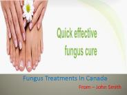 Laser Fungus Treatment