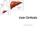 Liver Cirrhosis PowerPoint PPT Presentation