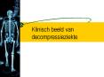 Klinisch beeld van decompressieziekte PowerPoint PPT Presentation