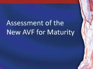 Assessment of the New AVF for Maturity