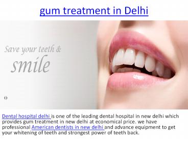 gum treatment in delhi