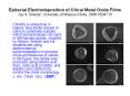 Epitaxial Electrodeposition of Chiral Metal Oxide Films Jay A. Switzer, University of Missouri-Rolla, DMR 0504715 PowerPoint PPT Presentation