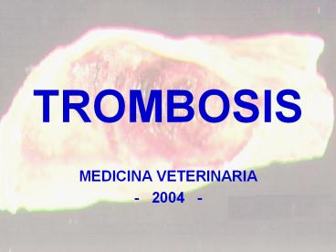 TROMBOSIS