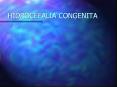 HIDROCEFALIA CONGENITA PowerPoint PPT Presentation