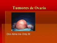 Tumores de Ovario