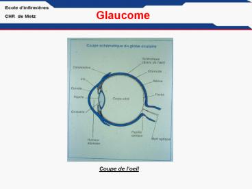 Glaucome