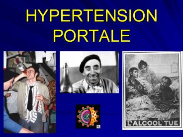HYPERTENSION PORTALE
